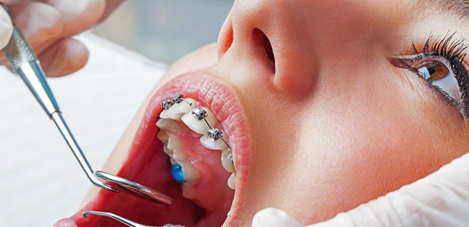 Dental Care: Taking Care Of Your Teeth As You Age